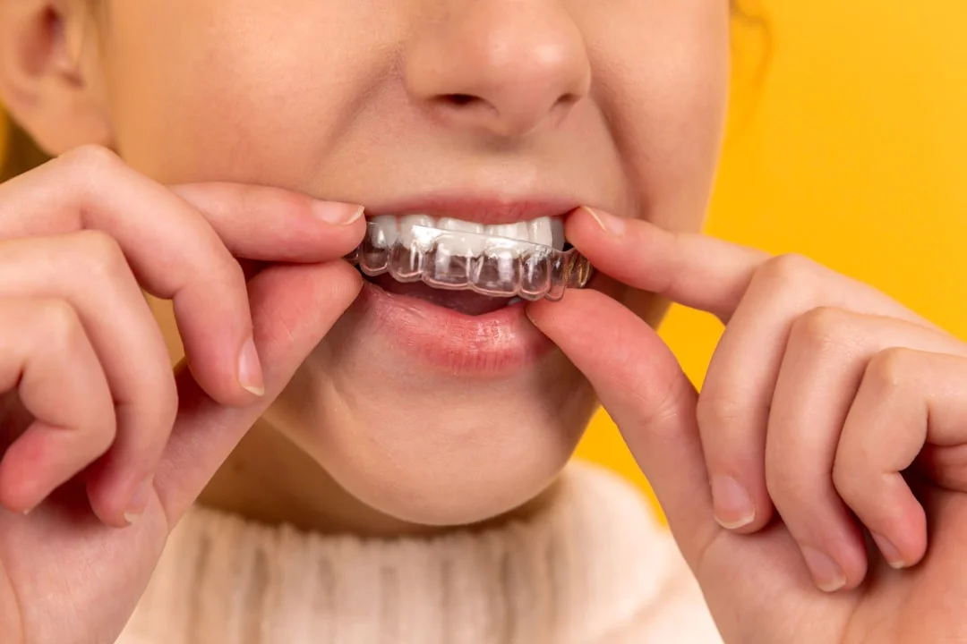 A person inserting a clear plastic dental aligner over their teeth against a yellow background