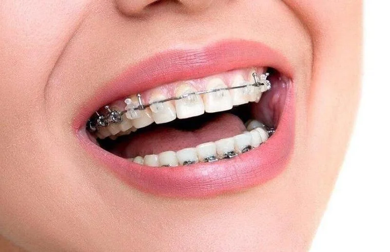 original_5cd2a8b0b9f6551da72edf6f_5c.jpg
