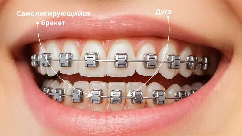 ligaturnie-samoligiruushie3.jpg